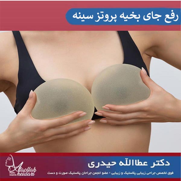 راز محو شدن جای بخیه عمل پروتز سینه ، هر آنچه باید بدانید !