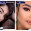 راز موفقیت در جراحی بینی استخوانی ؛ انتخاب جراح مناسب مهمتر از هر چیز است