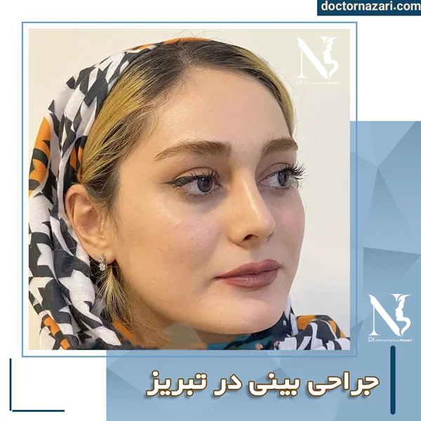عمل بینی در تبریز با دکتر محمدرضا نظری ؛ از مشاوره تا دوران نقاهت