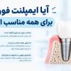 آیا ایمپلنت فوری برای همه مناسب است؟