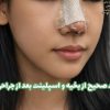 مراقبت صحیح از بخیه و اسپلینت بعد از جراحی بینی