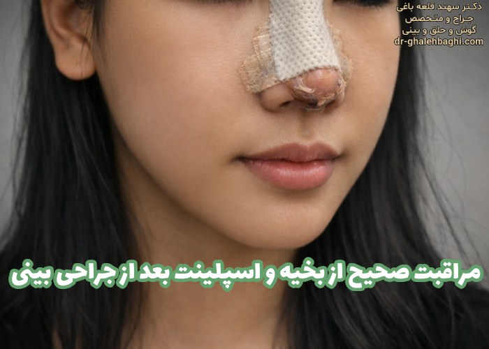مراقبت صحیح از بخیه و اسپلینت بعد از جراحی بینی