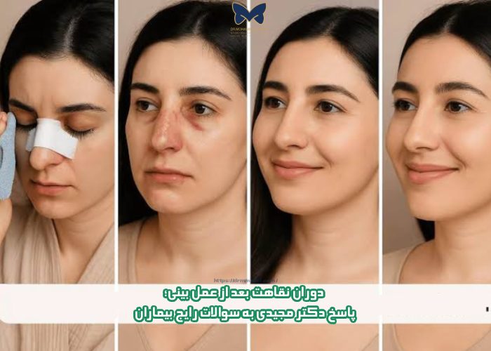 دوران نقاهت بعد از عمل بینی؛ پاسخ دکتر مجیدی به سوالات رایج بیماران