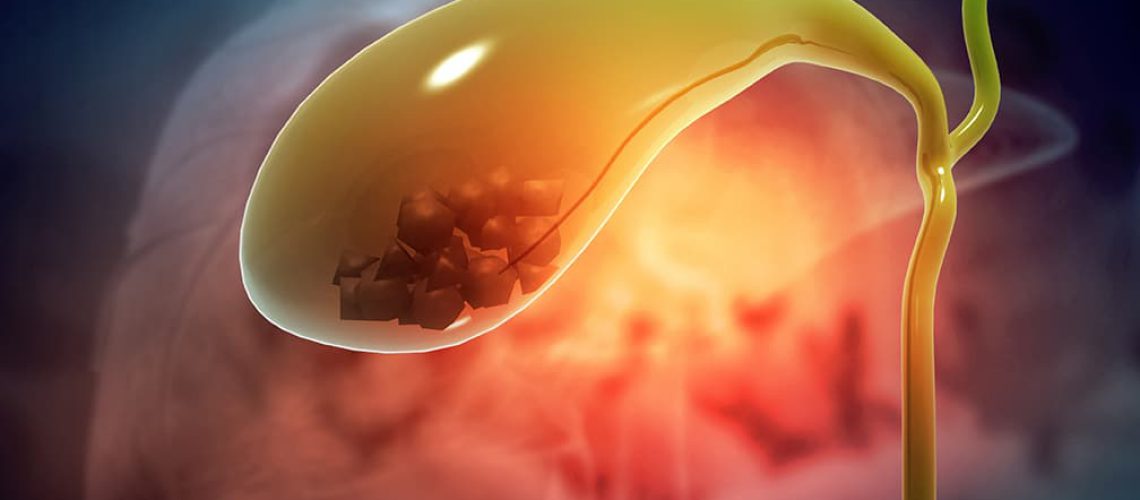 Blog-Image_Gallbladder_02.23.jpg