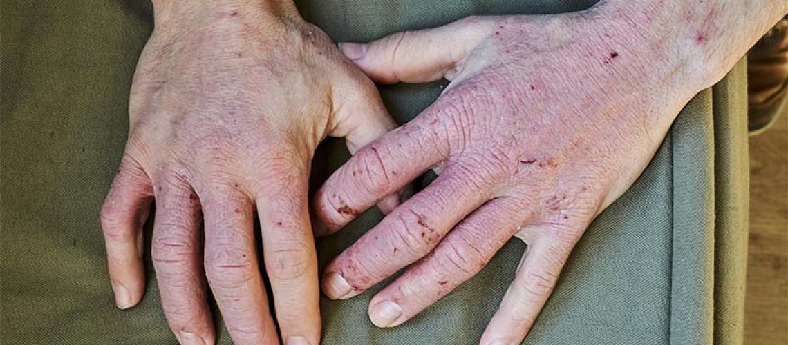 Identifying-and-Managing-Risk-Factors-for-Skin-Conditions-1.jpg