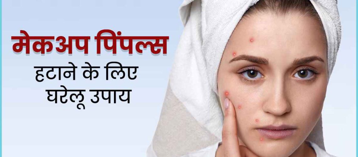 Makeup-Acne-Home-Remedies.jpg