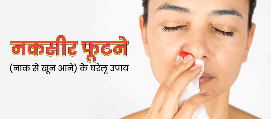 Nose-Bleeding-Home-Remedies-M.jpg