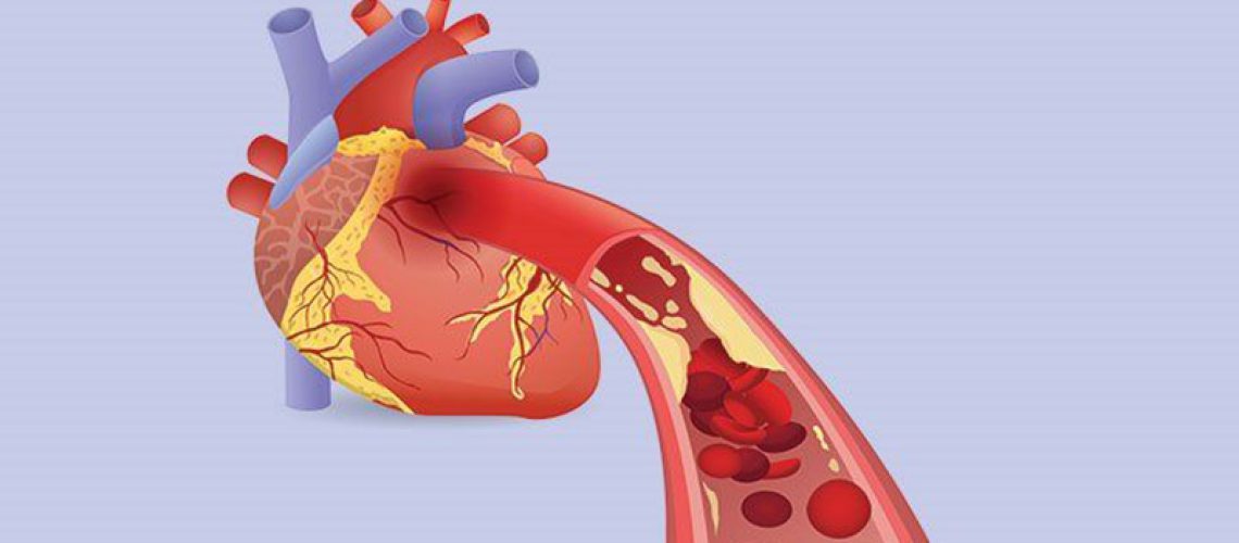 Treatment-Options-for-Heart-Conditions-Choosing-the-Best-Treatment.jpg