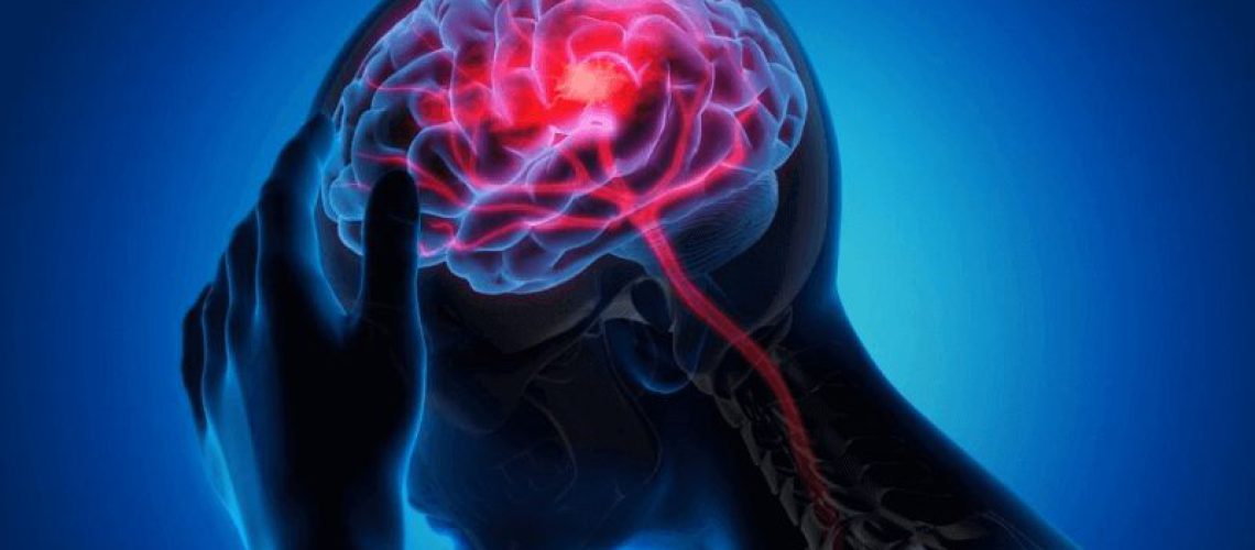 Treatments-for-Neurological-Conditions.png