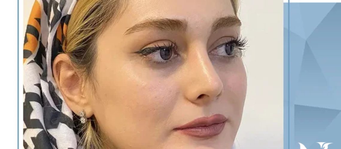 عمل بینی در تبریز با دکتر محمدرضا نظری ؛ از مشاوره تا دوران نقاهت
