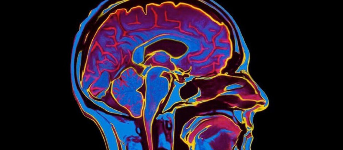 treating-brain-conditions.jpg
